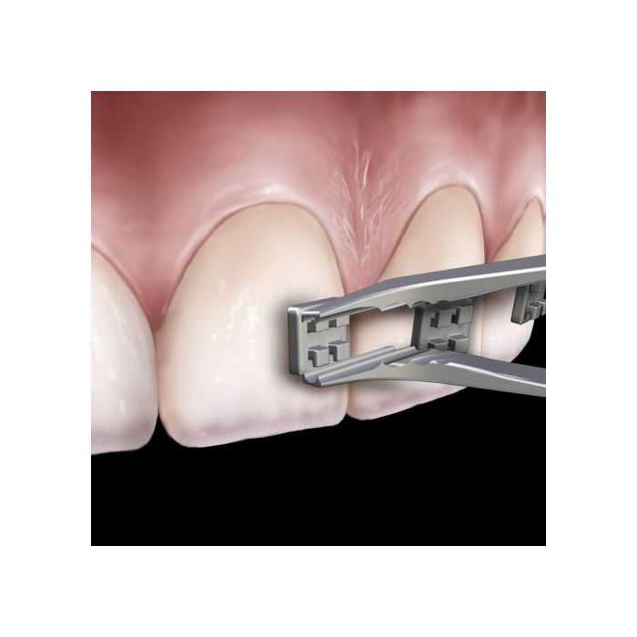 Pince ortho précelle à bague 